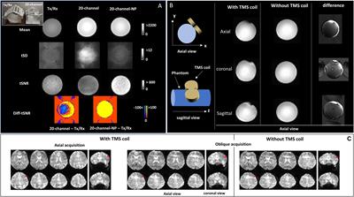 Simultaneous Transcranial Magnetic Stimulation and Functional Magnetic Resonance Imaging: Aspects of Technical Implementation